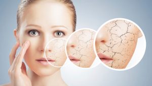 Da bị khô dày, sậm màu – Bệnh gì?