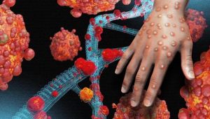 Trung tâm Y tế  Văn Chấn tập huấn trực tuyến Hướng dẫn tạm thời giám sát và phòng chống bệnh Đậu mùa khỉ