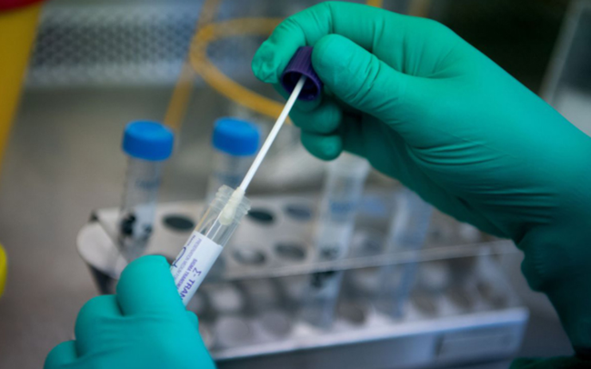 Mời cung cấp báo giá: Mua sinh phẩm Invitro