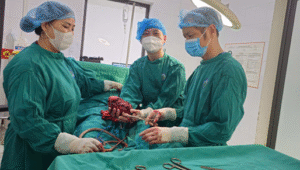 Phẫu thuật thành công cắt bỏ  khối u mặt sau đùi – thêm một dấu ấn tại trung tâm y tế khu vực Văn Chấn